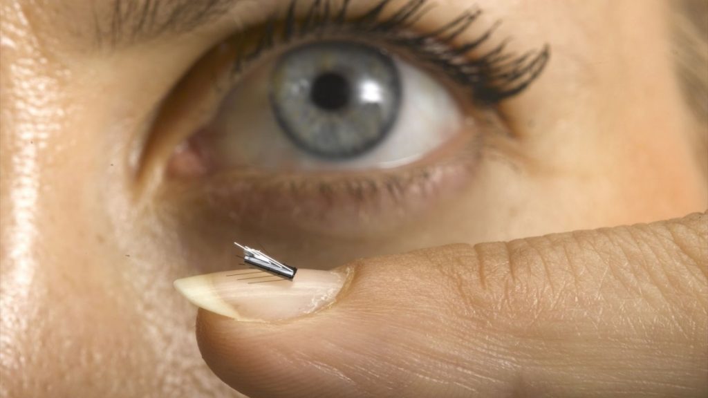 Prototype of the tiny ViRob from Microbot, which will allow surgeons to send a camera, medication or shunts into narrow, twisting parts of the body.Photo courtesy of Technion